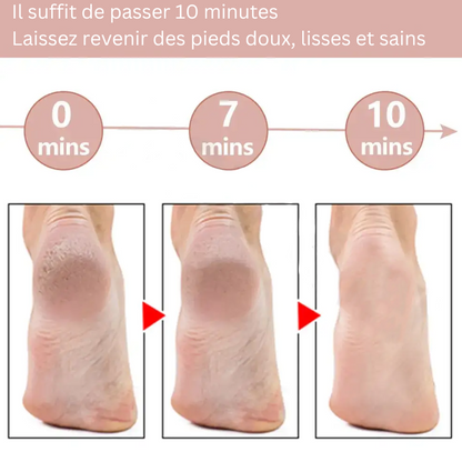 Exfoliant pour les pieds Reynoble